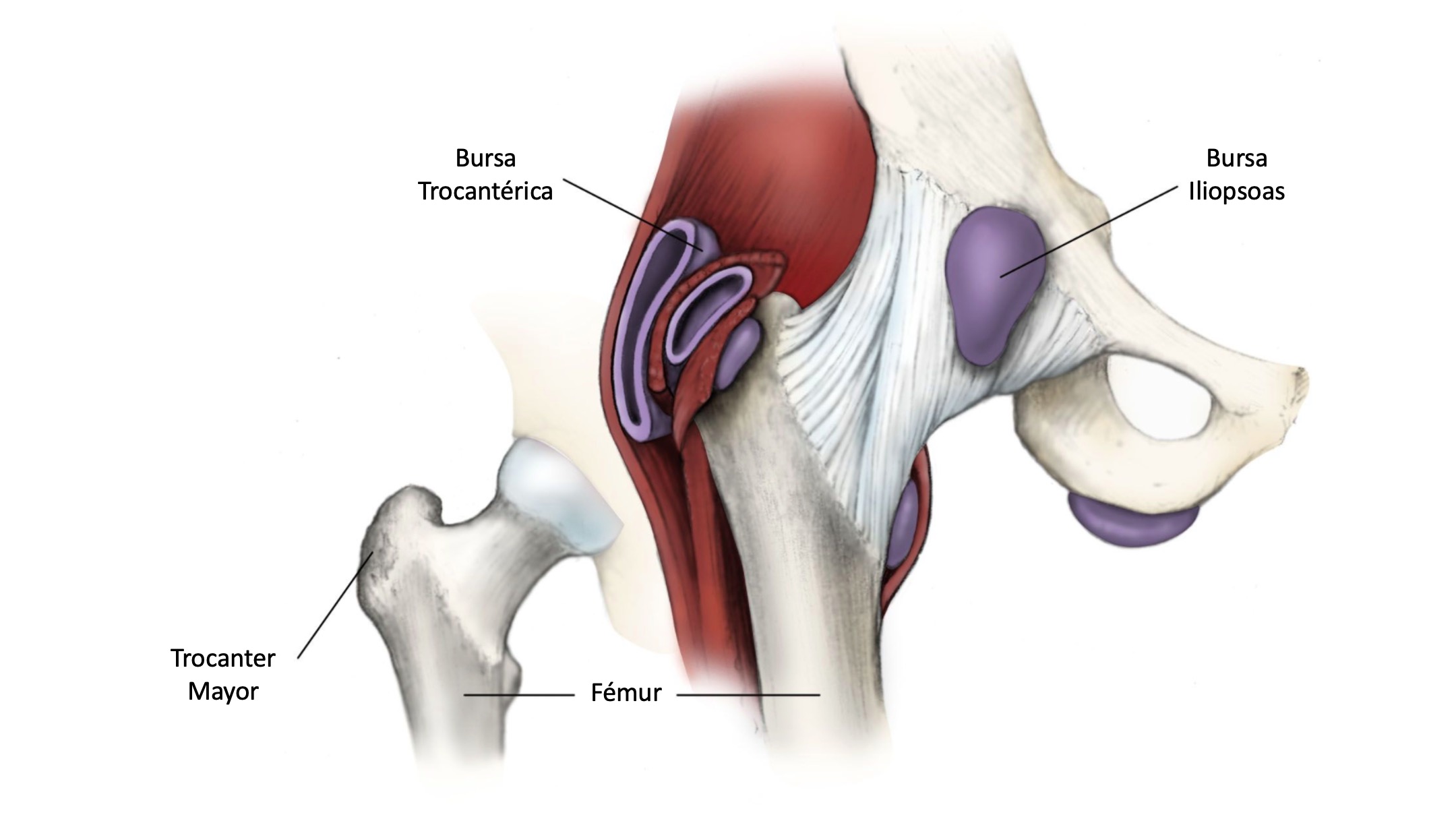 Лечение воспаление мышц тазобедренного сустава. Суставная сумка тазобедренного сустава анатомия. Бурсит синовиальной сумки тазобедренного сустава. Синовиальные сумки тазобедренного сустава анатомия. Zona orbicularis тазобедренного сустава.